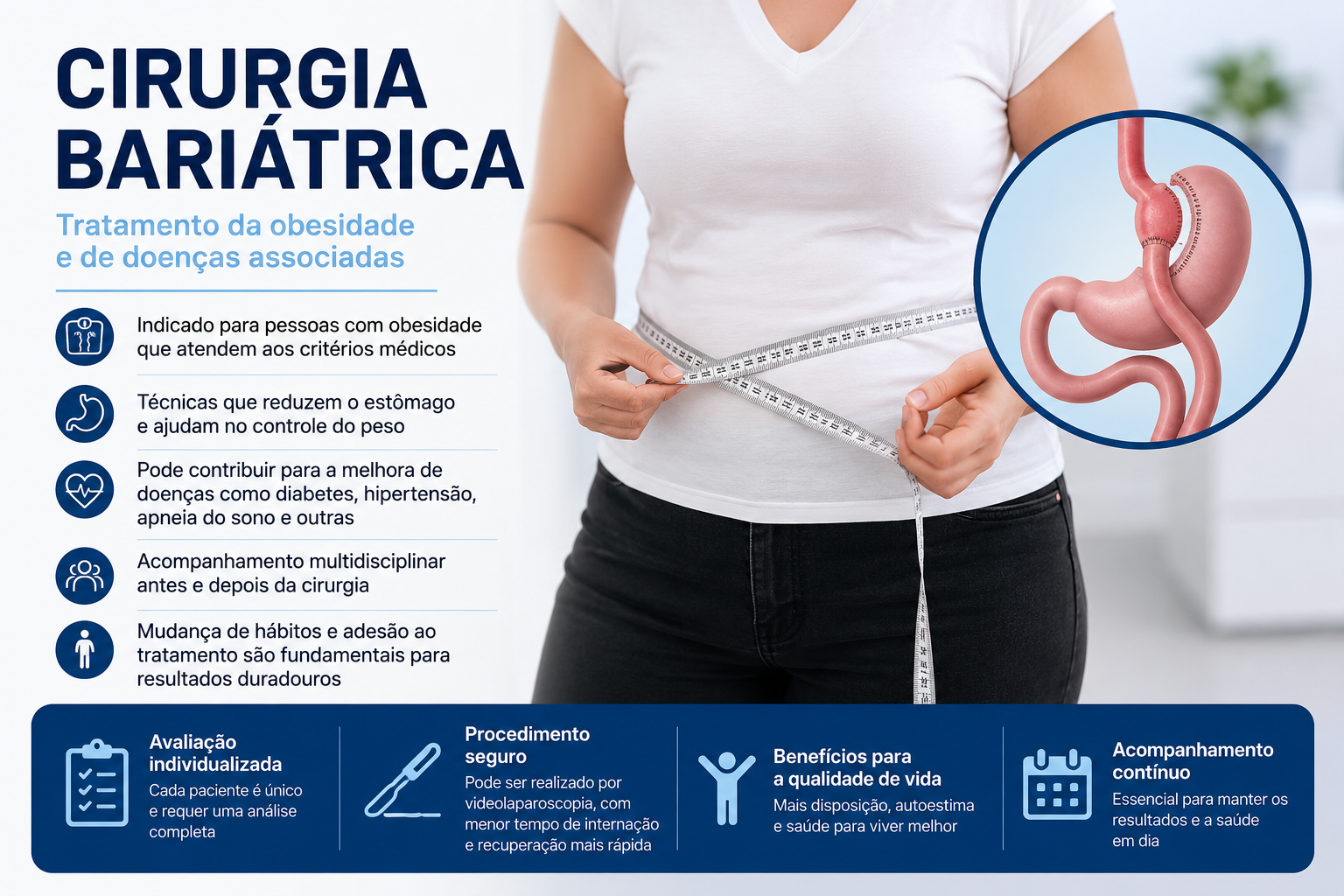 cirurgia bariátrica (2)